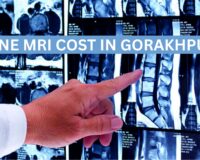 Spine MRI Cost in Gorakhpur – Easy Guide (2025)
