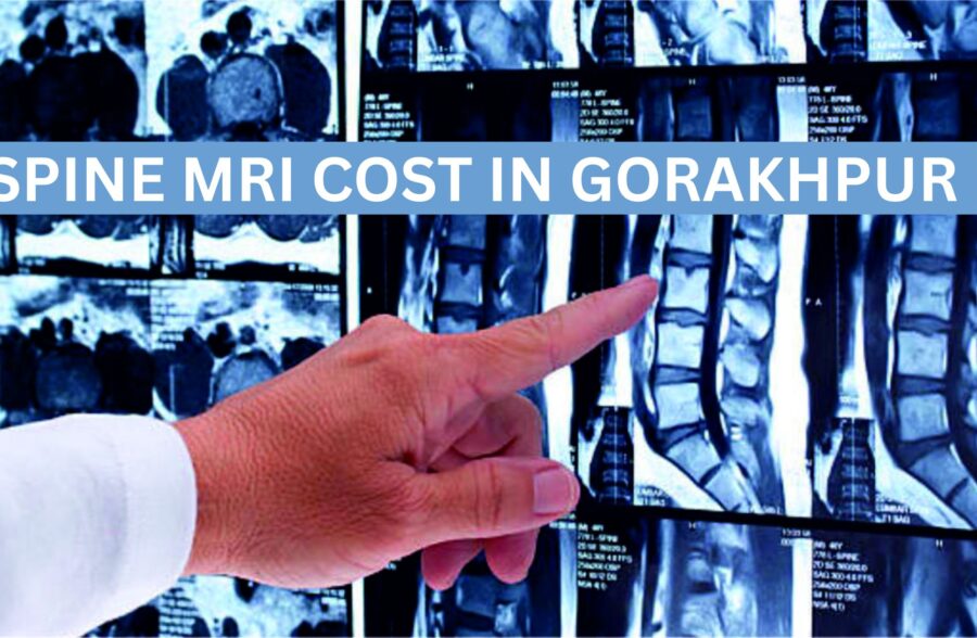 Spine MRI Cost in Gorakhpur